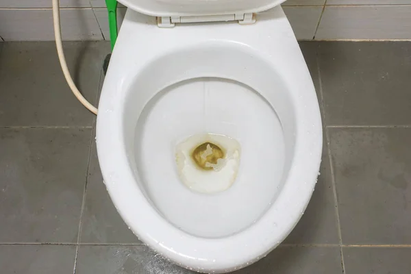 Schmutzige Weiße Toilettenschüssel Aus Nächster Nähe — Stockfoto