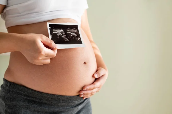 Gelukkig zwangere vrouw en verwacht baby thuis. — Stockfoto