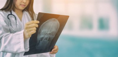 Kadın doktor muayene x ray görüntü içinde hastane.