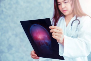Doktor kafa yaralanması hasta xray film bakıyor