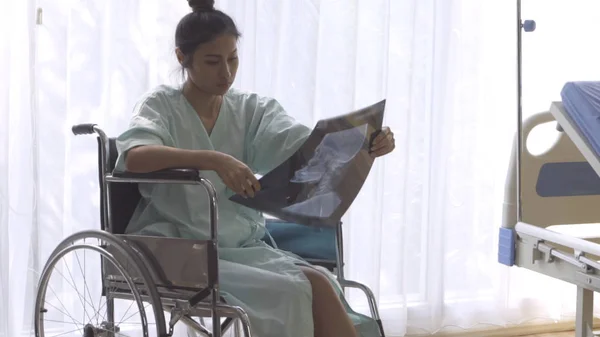 Paciente seria mirando la imagen de rayos X de su aumento de lesiones cerebrales — Foto de Stock