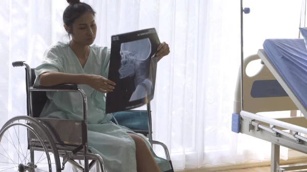 Paciente seria mirando la imagen de rayos X de su aumento de lesiones cerebrales — Foto de Stock