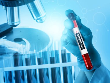 Coronavirus COVID 19 tıbbi test aşısı araştırma ve geliştirme konsepti. COVID-19 için ilaç tedavisi üretmek üzere Coronavirus antikor bilimsel örneklerini inceleyen ve analiz eden bilim insanları.