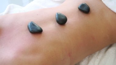 Kaplıcadaki terapistin sıcak taş masajı tedavisi.